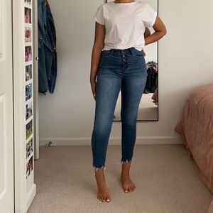Abercrombie Cropped Skinny Jeans